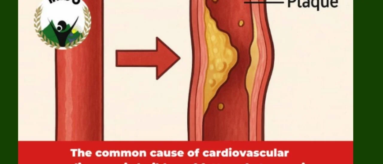 The Hidden Killer in Your Food: How Trans Fats Are Damaging Your Heart”